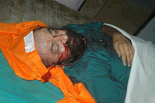 jaspal bhatti dead, jaspal bhatti died, jaspal bhatti death, jaspal bhatti accident